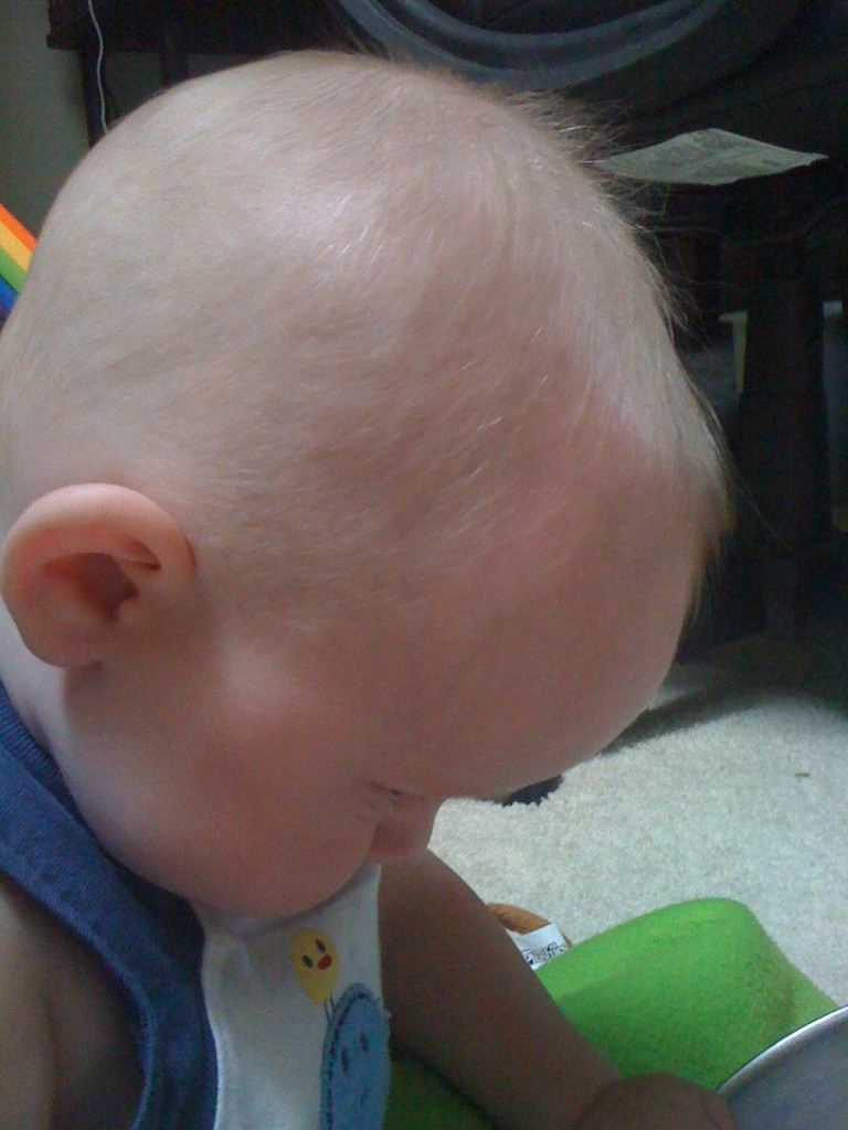 My bald baby has HAIR!
