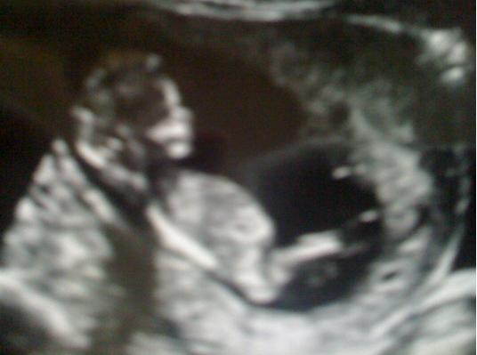 Who wants to see the baby?!