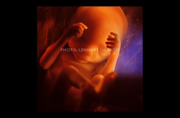 week 24 fetus